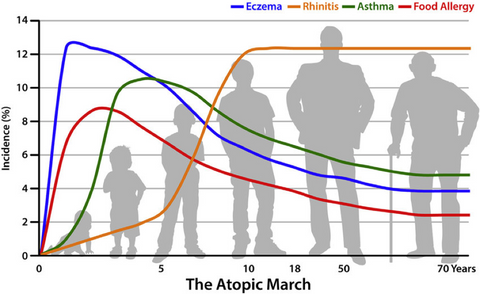 Atopic March