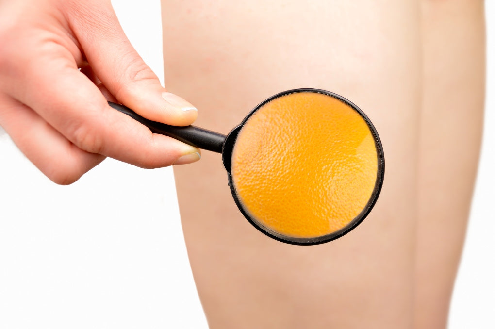 Cellulite bei männern am po