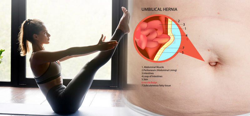 painful hernia