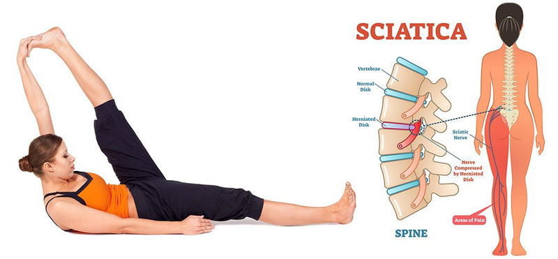 Pain Relieving Exercises For Sciatica Everyday Medical