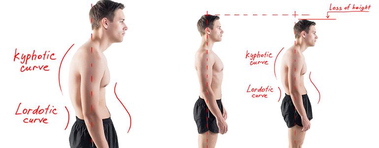 Improve Your Posture