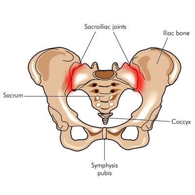 Sacroiliac Joint Pain