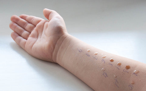 Child’s arm during a skin prick test – liquid drops containing allergens may cause a reaction like a mosquito bite