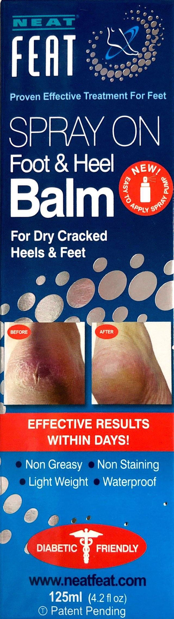 cracked heel spray