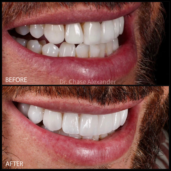 View 2 of Buck Wimberly's dentistry work by Chase Tomcala at Westwood Aesthetic Dentistry