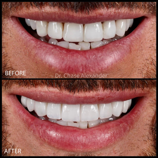 View 1 of Buck Wimberly's dentistry work by Chase Tomcala at Westwood Aesthetic Dentistry