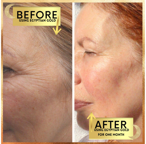 Grounded Body Egyptian Gold Retinol serum before and after amazing results