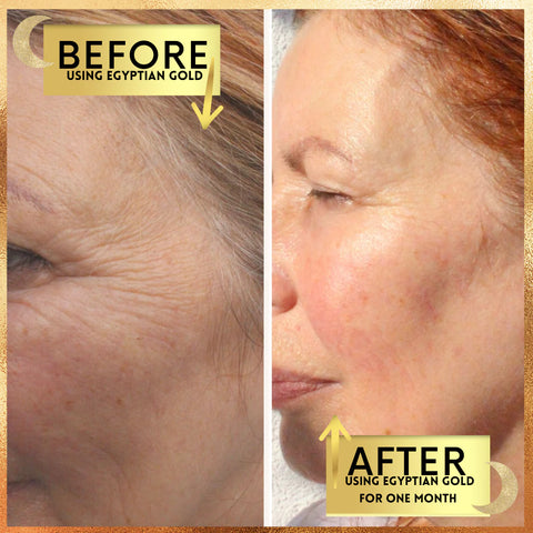 grounded body retinol egytian gold before and after antiageing