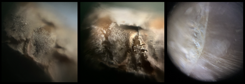 Picture of acorn cupule scales (left and middle) and a whole acorn (right) viewed under a Foldscope 2.0 at 50X magnification with reflective lighting