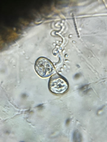 Picture of vorticella viewed under a Foldscope 2.0 at 140X magnification plus 5X zoom on phone