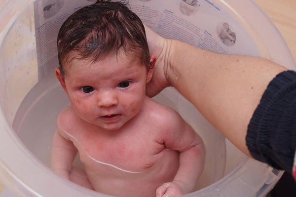 baby with eczema taking a bath