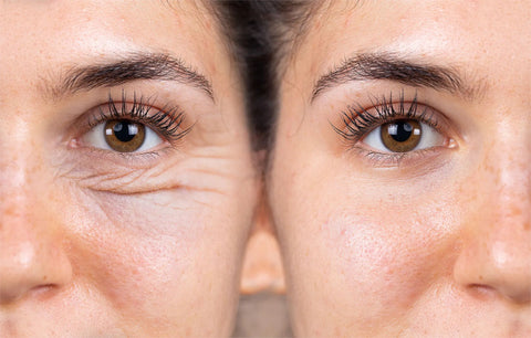 Instant Eye Lift Cream Before and After