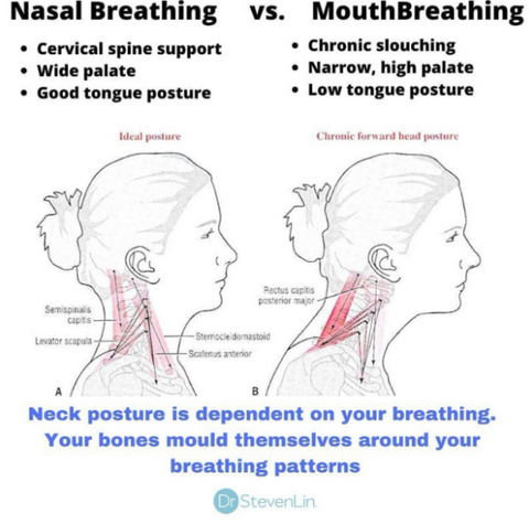 Nasal breathing supports proper body posture, mouth breathing does not