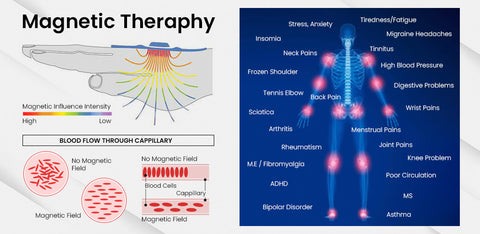 Magnetic Therapy