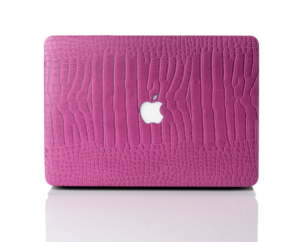 Pink Stardust Glitter MacBook Case –