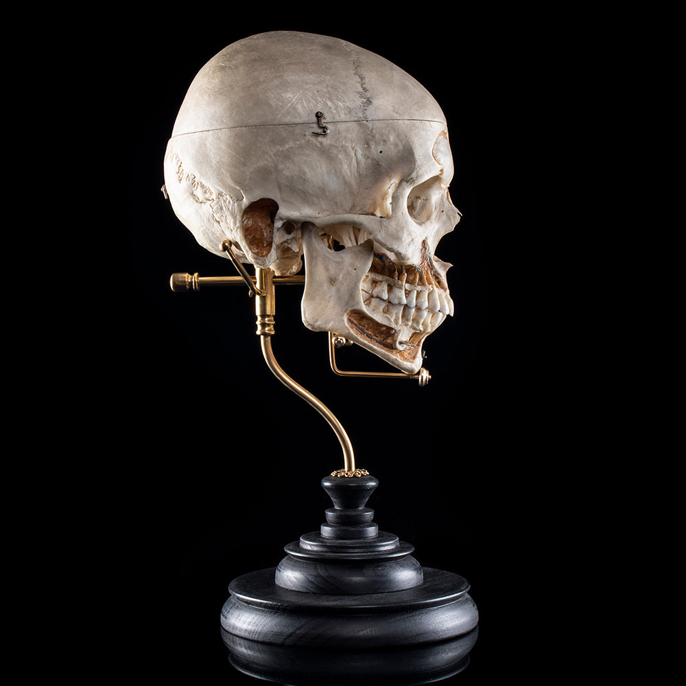 Real human Bones – Mattaeus Ball