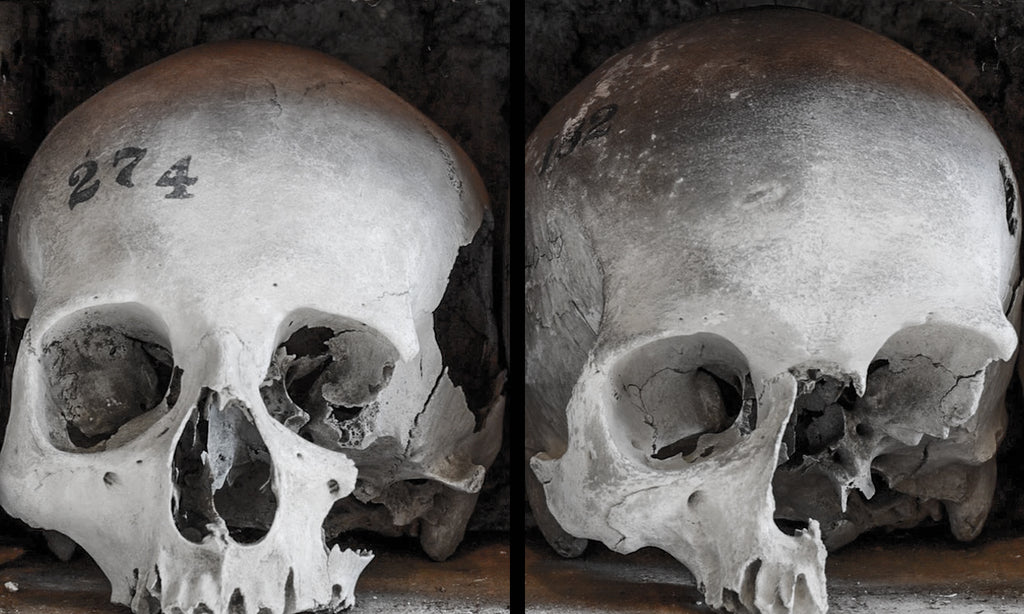 Real human skulls, are they legal to own