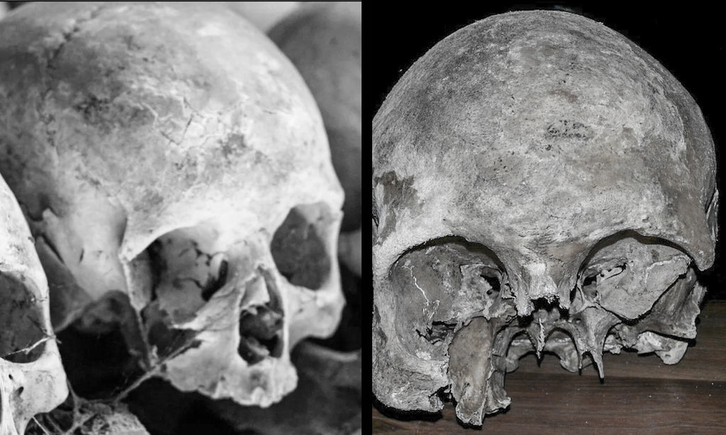 Real human skulls, are they legal to own