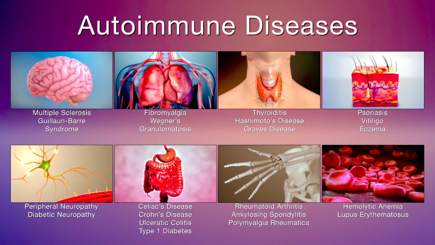 The Rise Of Autoimmune Diseases #HP-EVOO - Blog # 97 – The Virgin Olive ...