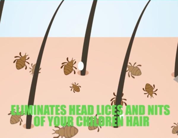 LICE-X™ Automatic Head Lice Eliminator