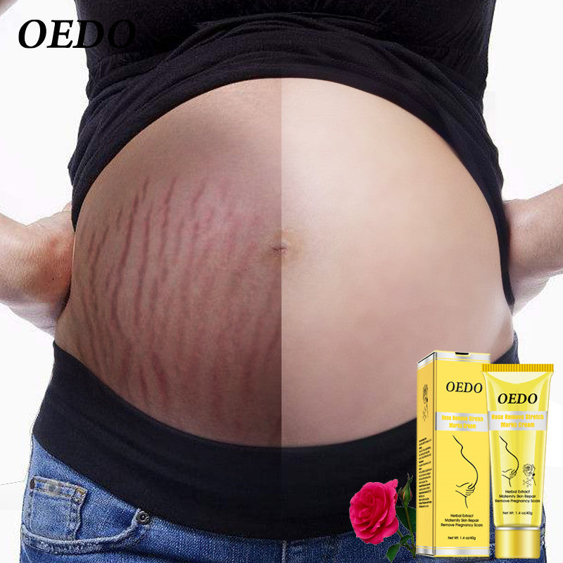 Rose Verwijderen Striae Creme Anti Rimpel Anti Aging Moederschap Huid Reparatie Verwijderen Zwangerschap Littekens Behandeling Body Huidverzorging Grandado Com