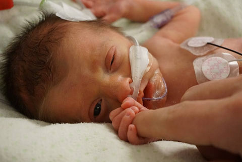 A Preemie Journey