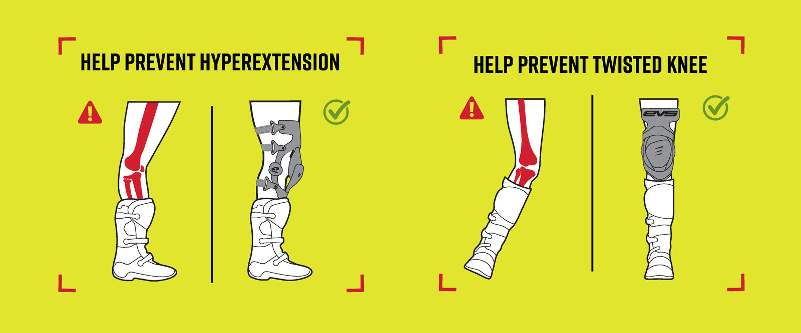 EVS Knee Braces Prevention