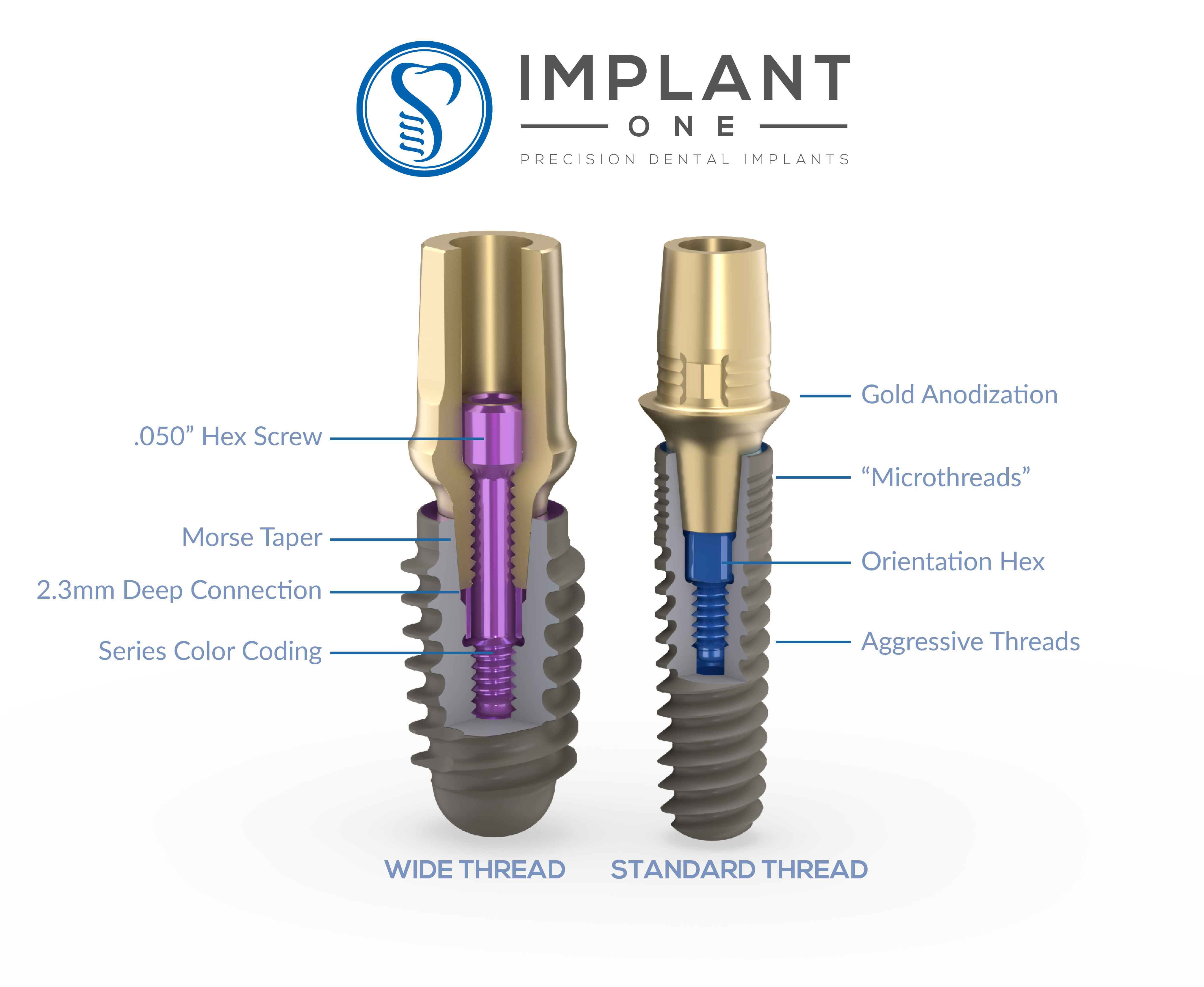 Bar Thread for Dental Implant Overdenture | Zest Compatible