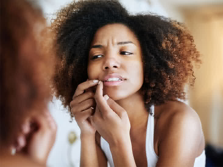 How To Treat Acne And Dry Skin