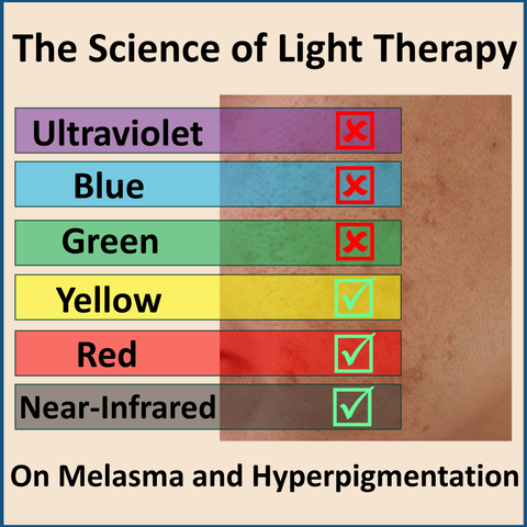 best wavelengths hyperpigmentation melasma led light therapy photobiomodulation