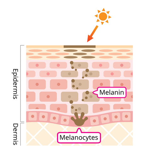 sunlight light therapy melanin pigment hyperpigmentation