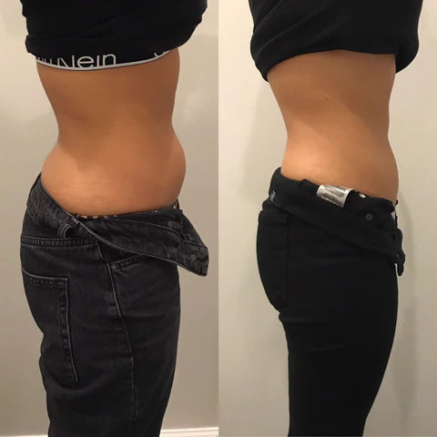 TSG BODY CONTOURING