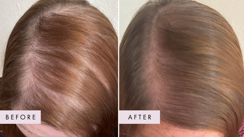 Hair Gain Scalp Foam Before and After Images