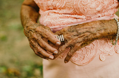 woman with varicose veins