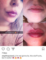 Lip Voltage