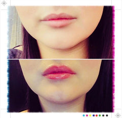 Lip Voltage