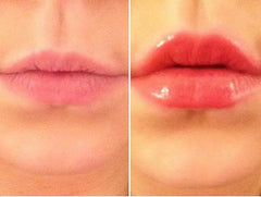 Lip Voltage