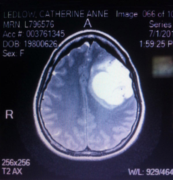 Catherine Wreford Brain Scan