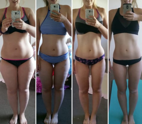 ultrasonic cellulite machine before and after