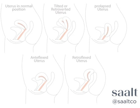 Uterus positions illustration