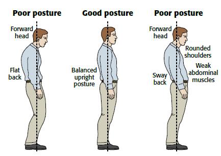 Posture Max™ - Posture Corrector & Back Support