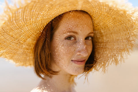 how to tell freckles from skin spots