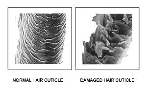 Damaged Cuticle Skin Barrier