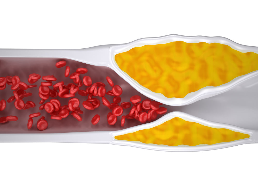 varicose veins enzyme serrapeptase