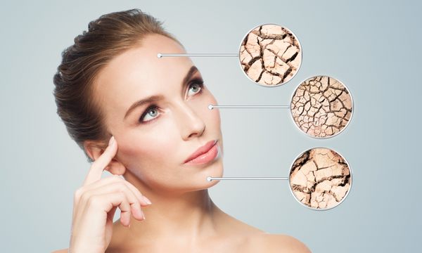 WHAT CAUSES DRY SKIN?