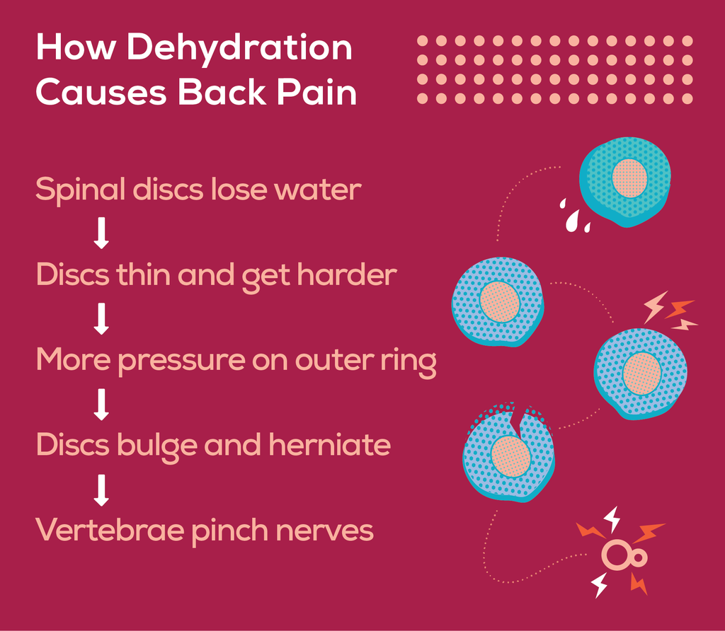 Graphic showing the process of dehydration leading to back pain. Lower hydration levels cause discs to lose water, get thin, and be less able to handle pressure. Bulges and herniations can result.