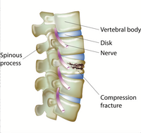 Dr. Lani Simpson DC, CCD - Osteoporosis & Bone Health Expert, Author