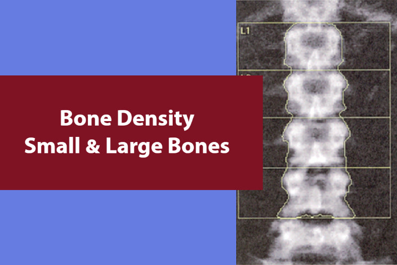 bone density scan