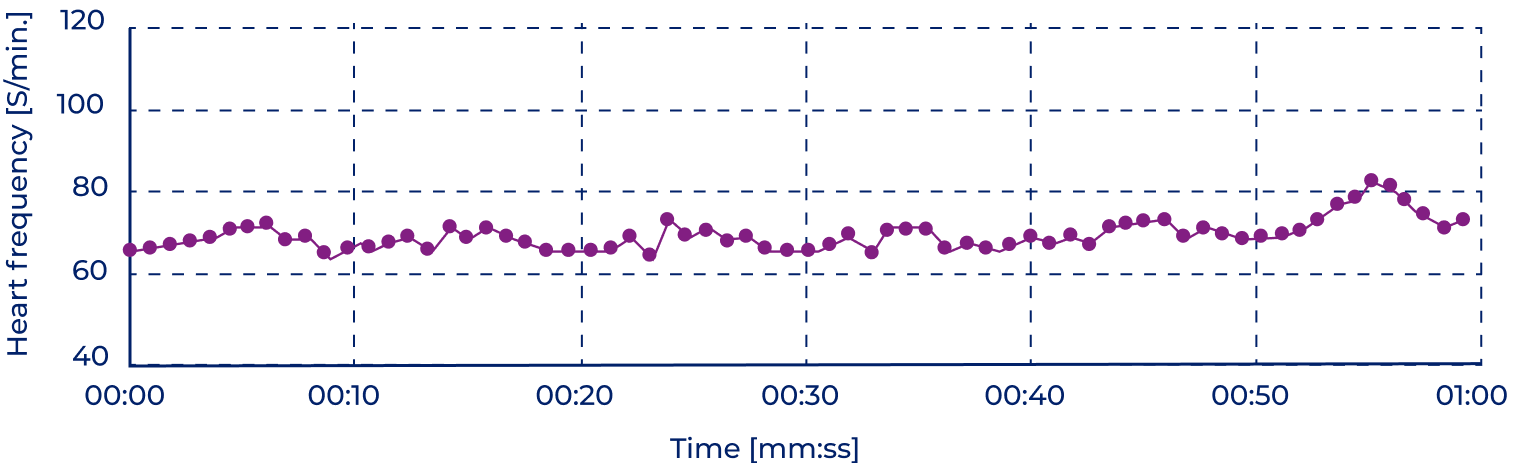 Heart rate variability before using Somavedic