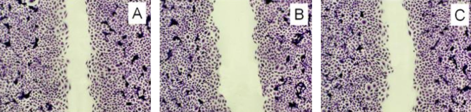 Micrograph of cell regeneration/wound healing after 16 hours or migration and proliferation of connective tissue fibroblast